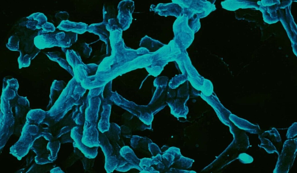 Dream typhoid - dream meaning typhoid