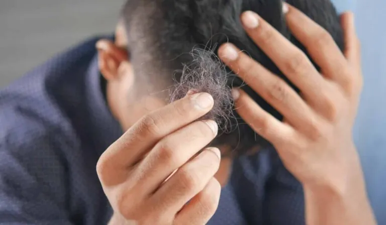 Soñar que se cae el pelo - significado de soñar que se cae el pelo