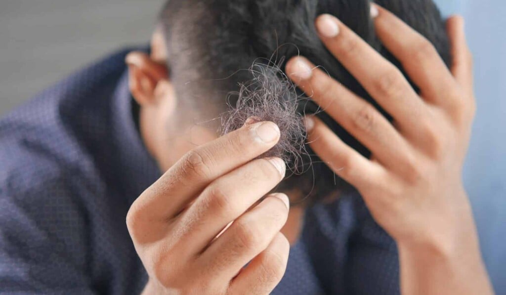 Soñar que se cae el pelo - significado de soñar que se cae el pelo