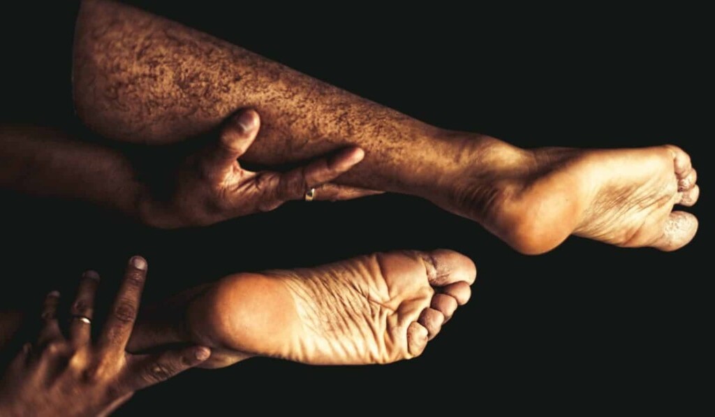 Sognare occhi di mais o di vermi - significato dei sogni occhi di mais o di vermi