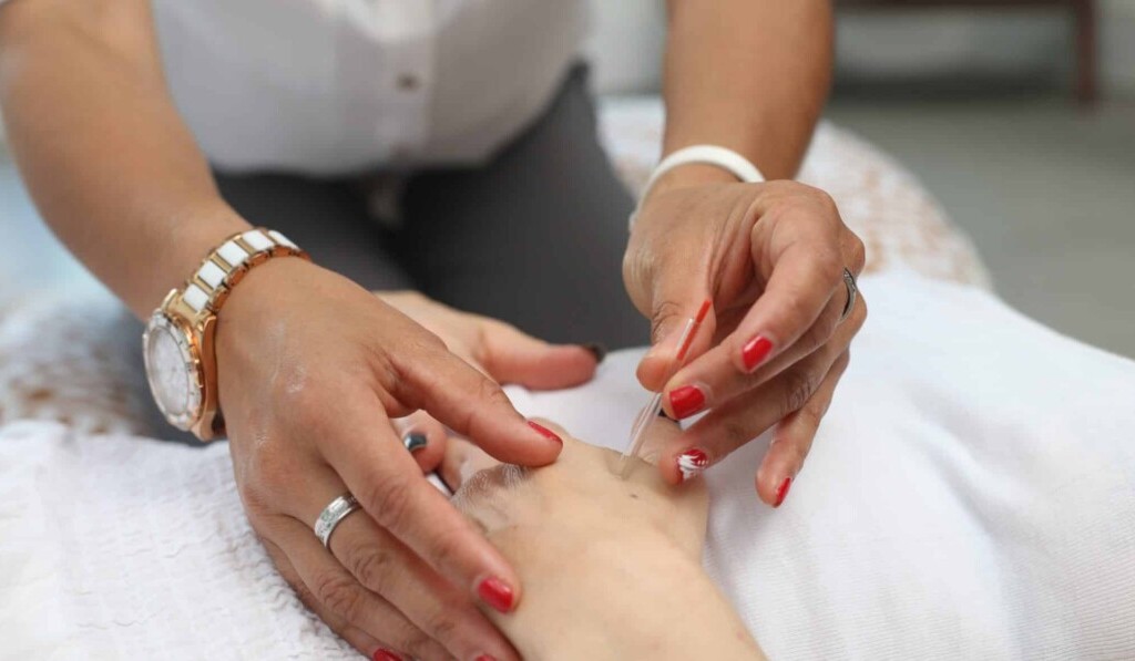 Rêve d'acupuncture - signification du rêve acupuncture